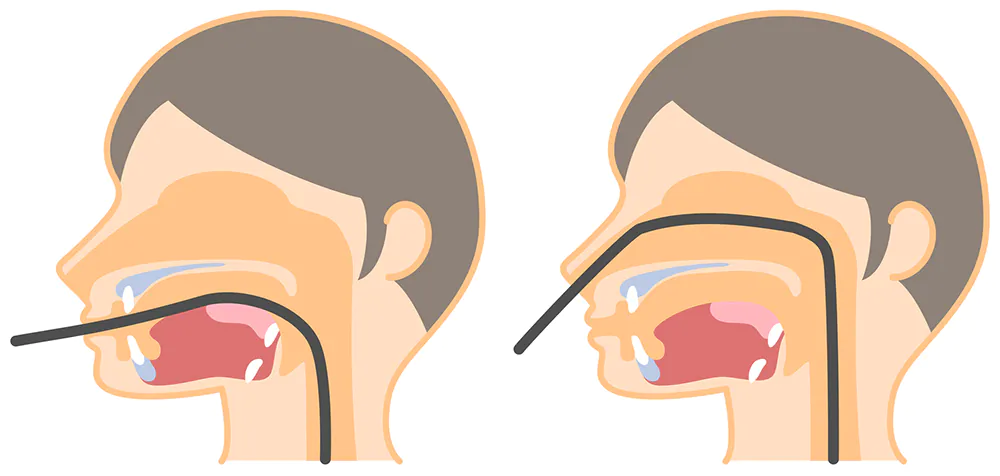 特徴3　経口内視鏡・経鼻内視鏡の選択が可能